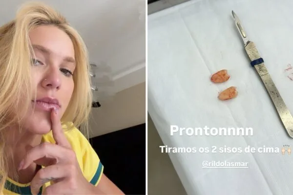 Virginia Fonseca retira dois sisos após sentir fortes dores