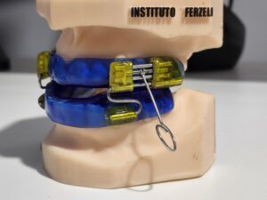Ronco e apneia do sono podem indicar distúrbio respiratório