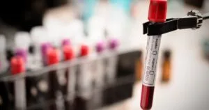 Teste que detecta 50 tipos de câncer chega ao Brasil Teste que detecta 50 tipos de câncer chega ao Brasil