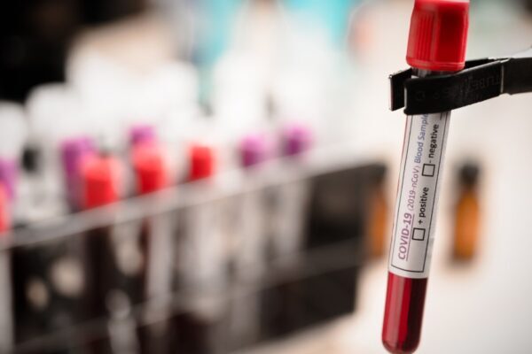 Teste que detecta 50 tipos de câncer chega ao Brasil