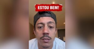 Paralisia de Bell: famosos que tiveram a mesma condição que Albani